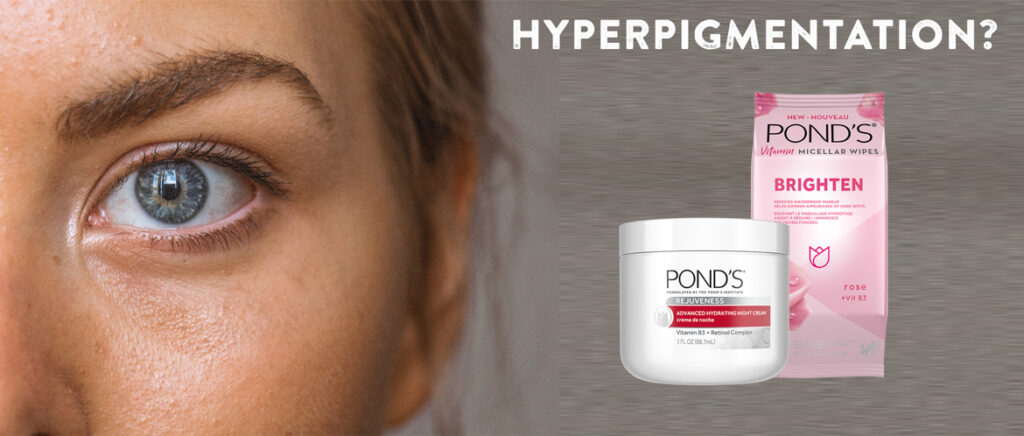ponds hyper pigment