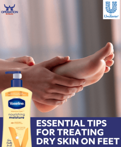 Vaseline Essential Tips for Treating Dry Skin on Feet article copy
