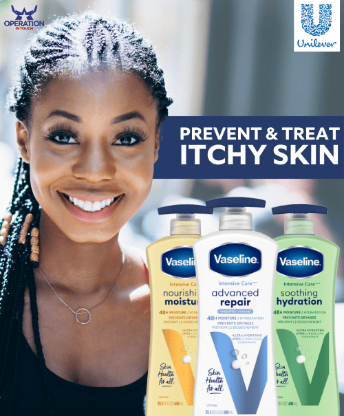 Prevent & Treat Itchy Skin Vaseline prevent treat itchy skin article copy