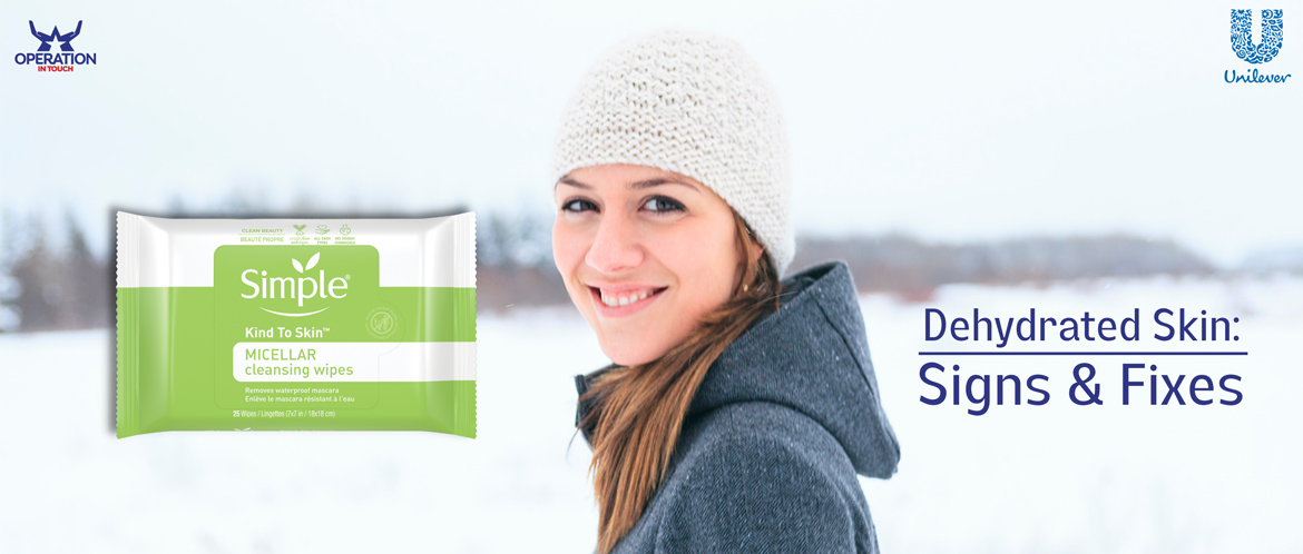 Simple dehydrated skin signs fixes carousel